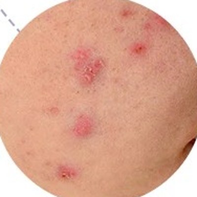 
Close-up of skin with a few blemishes
