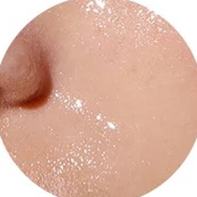 
Close-up of shiny, oily skin