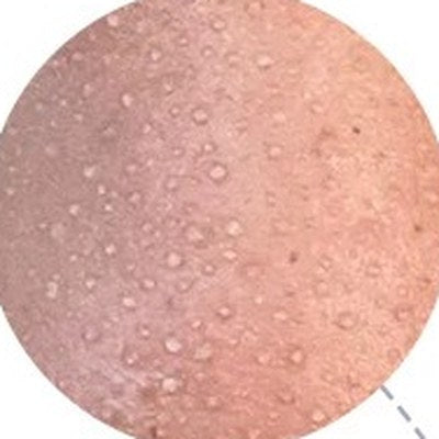 
Close-up of skin with small whiteheads